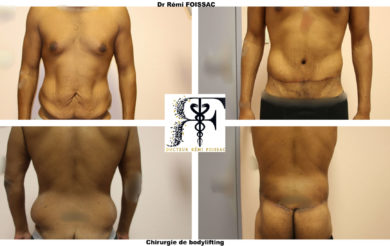 bodylifting 1