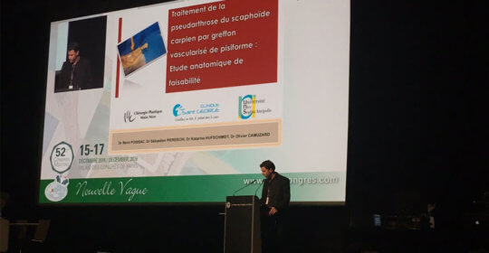 Présentation au Congrès National de Chirurgie de la Main