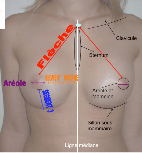 Sein schema
