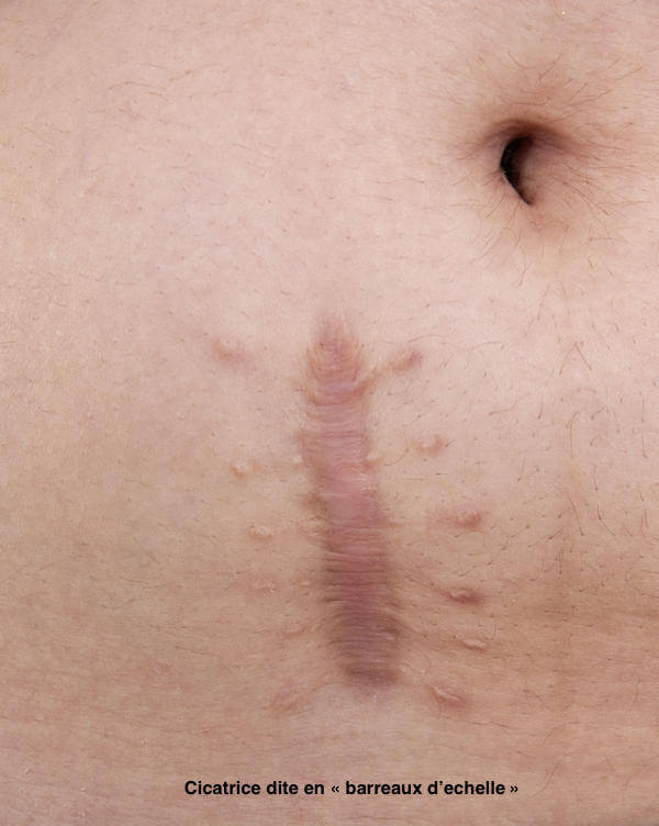 Prenez Soin De Vos Cicatrices