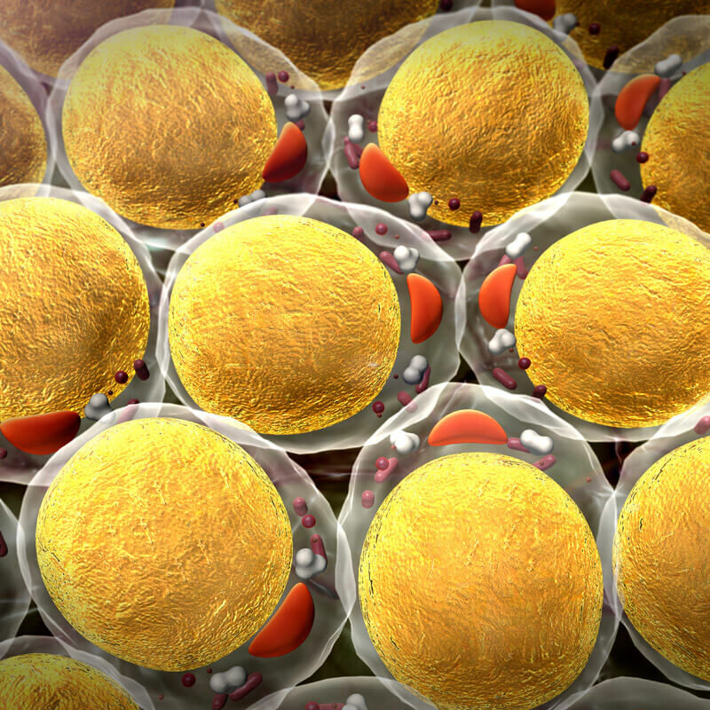 iStock_fat-cells-3x2