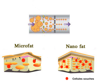 nanofat1